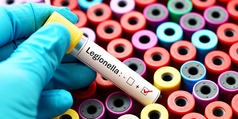 Legionella Prevention and Water Treatment Managers course