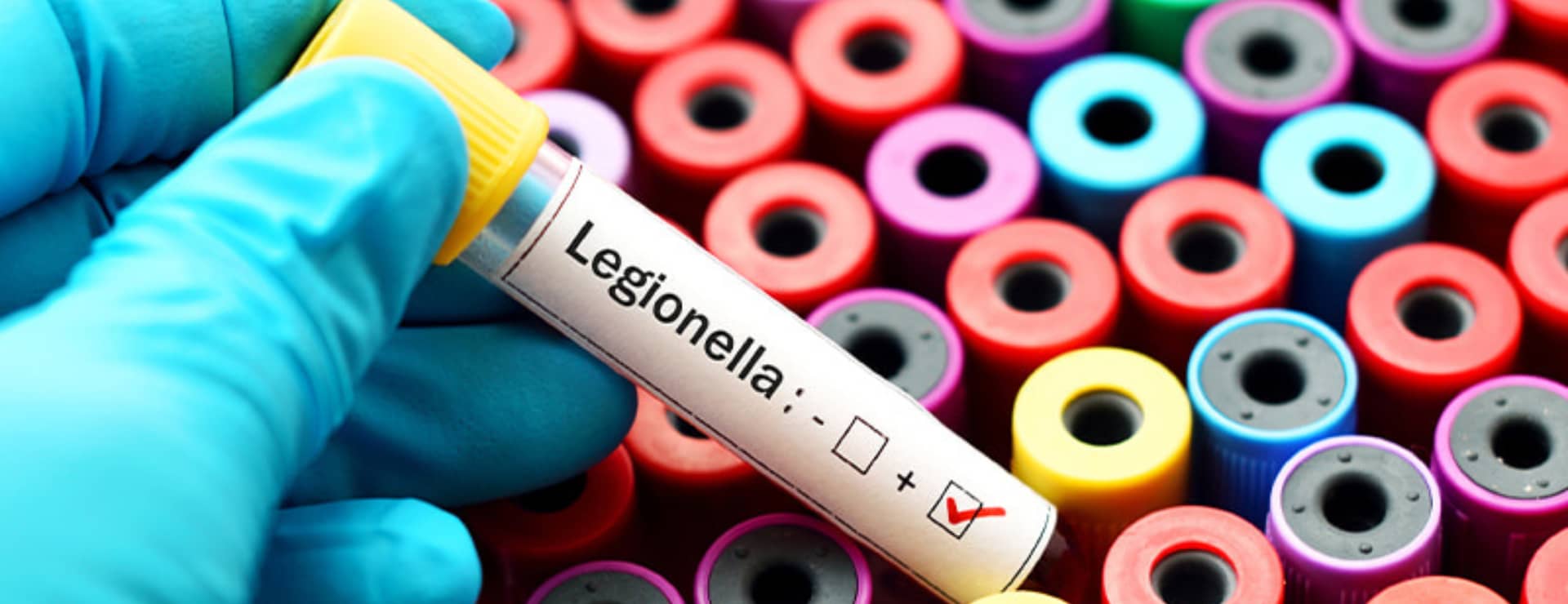 A person testing for legionella