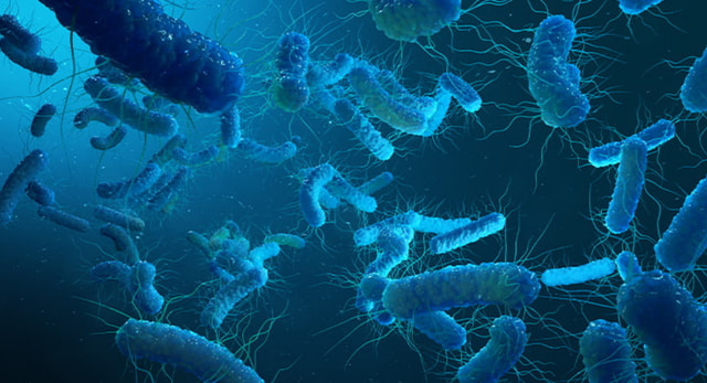 Legionella